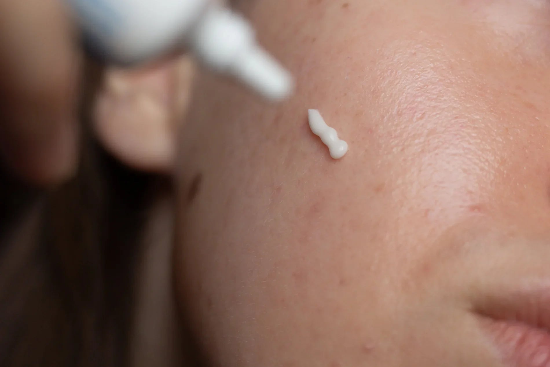 Why Skin Ageing Requires Both Correction and Support